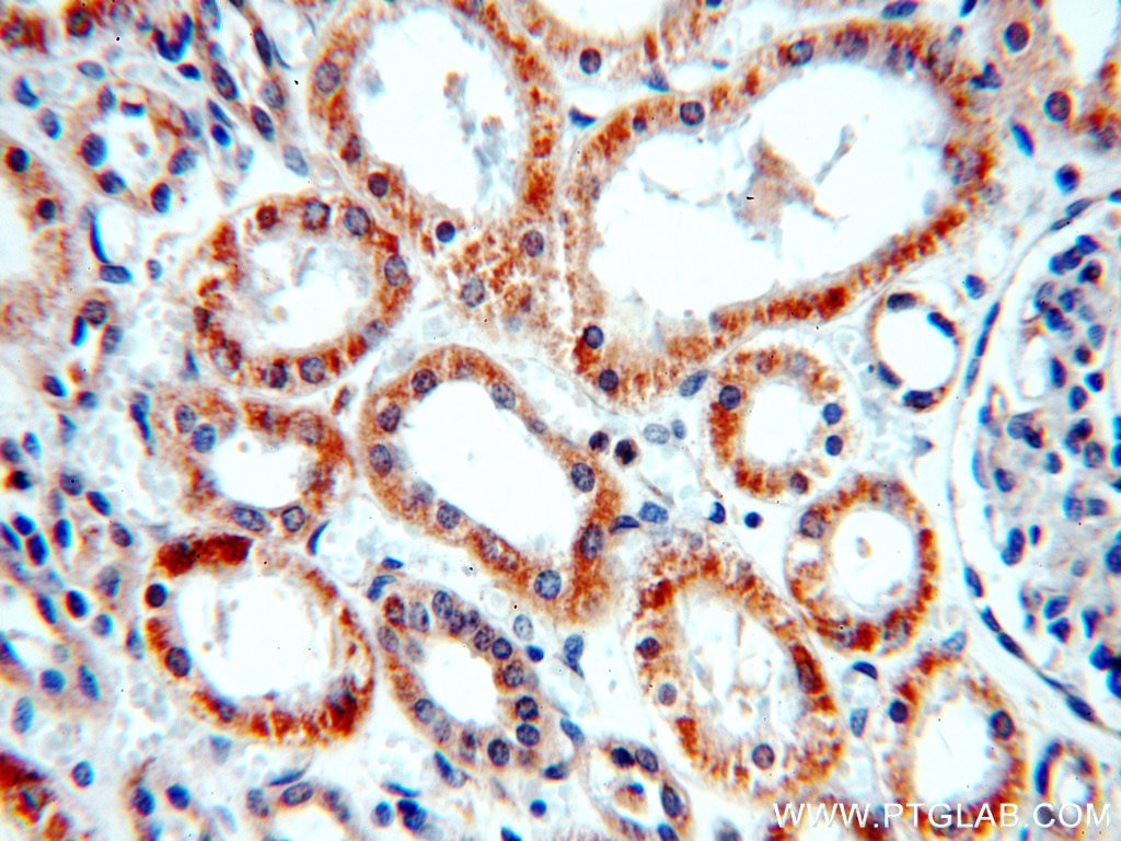 Immunohistochemistry (IHC) staining of human kidney tissue using NARFL-Specific Polyclonal antibody (20209-1-AP)