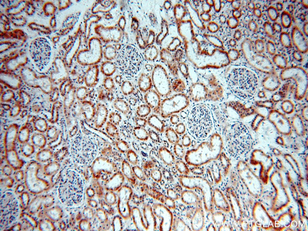 Immunohistochemistry (IHC) staining of human kidney tissue using NARFL-Specific Polyclonal antibody (20209-1-AP)