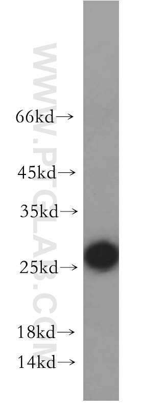 Western Blot (WB) analysis of HEK-293 cells using NARFL-Specific Polyclonal antibody (20209-1-AP)