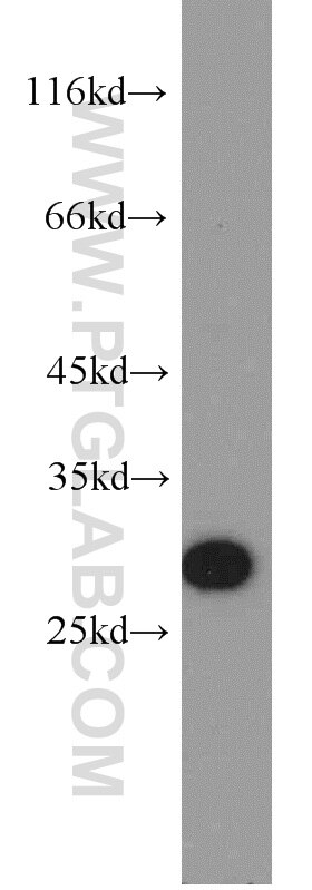Western Blot (WB) analysis of HEK-293 cells using NARFL-Specific Polyclonal antibody (20209-1-AP)