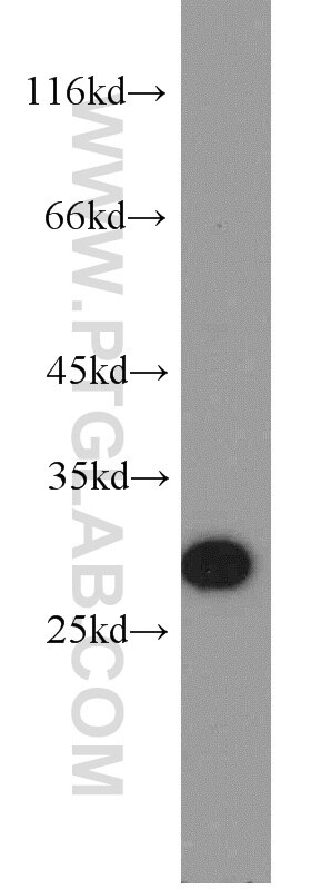 WB analysis of HEK-293 using 20209-1-AP