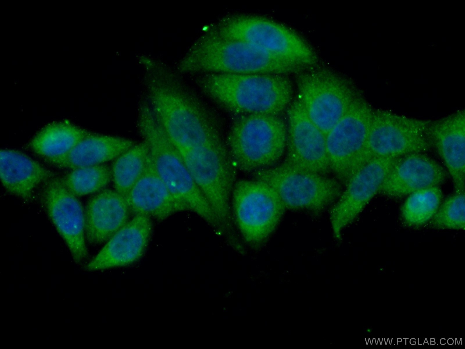 Immunofluorescence (IF) / fluorescent staining of HeLa cells using NARG1 Polyclonal antibody (23845-1-AP)