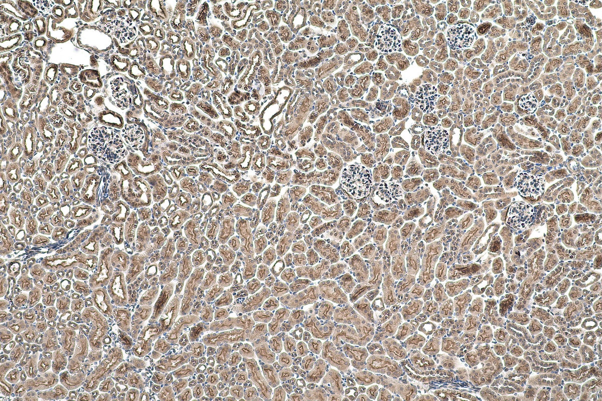 Immunohistochemistry (IHC) staining of mouse kidney tissue using NARG1 Polyclonal antibody (23845-1-AP)