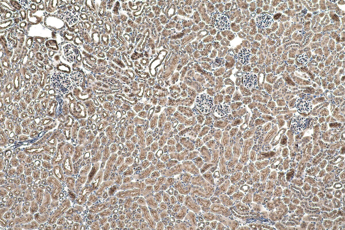 IHC staining of mouse kidney using 23845-1-AP