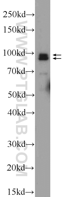 Western Blot (WB) analysis of HEK-293 cells using NARG1 Polyclonal antibody (23845-1-AP)