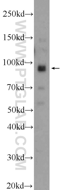 Western Blot (WB) analysis of HeLa cells using NARG1 Polyclonal antibody (23845-1-AP)