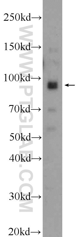 WB analysis of HeLa using 23845-1-AP