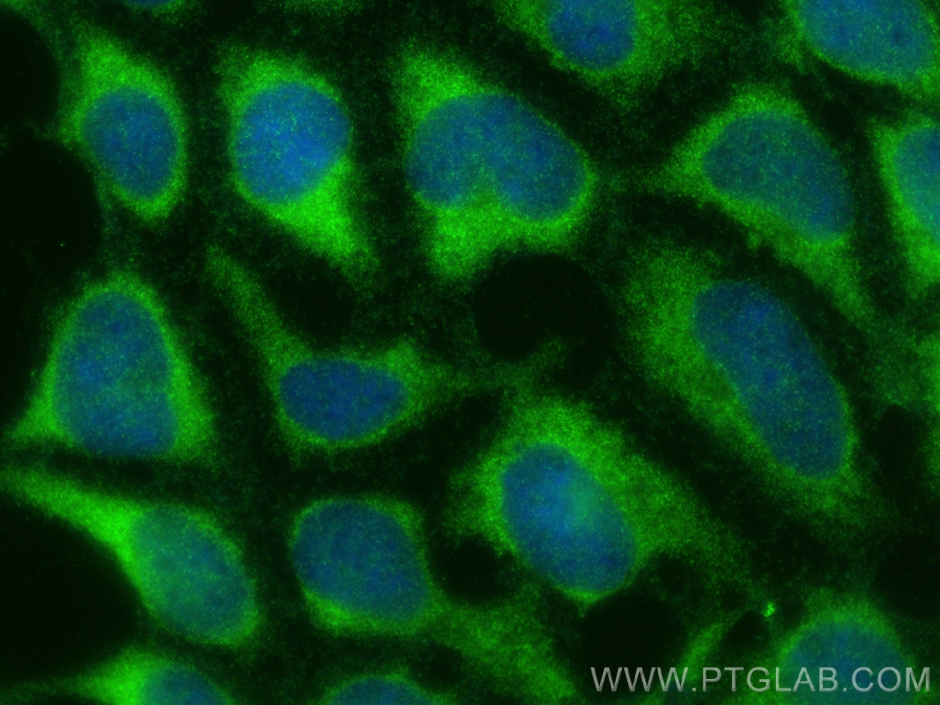 Immunofluorescence (IF) / fluorescent staining of HEK-293 cells using NARG1L Polyclonal antibody (17427-1-AP)