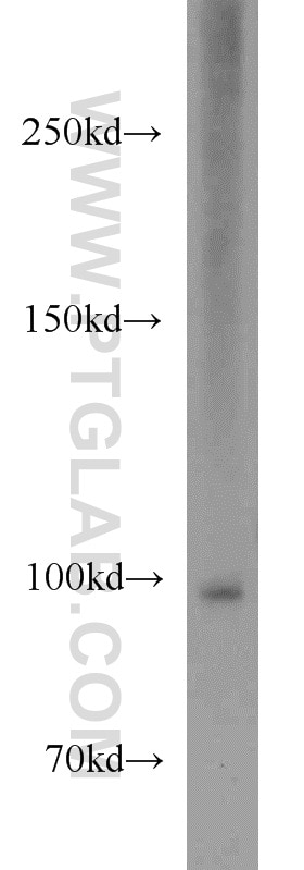 Western Blot (WB) analysis of Jurkat cells using NARG1L Polyclonal antibody (17427-1-AP)