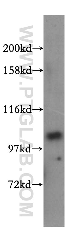 Western Blot (WB) analysis of Jurkat cells using NARG1L Polyclonal antibody (17427-1-AP)