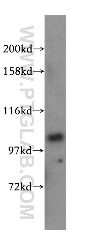 WB analysis of Jurkat using 17427-1-AP