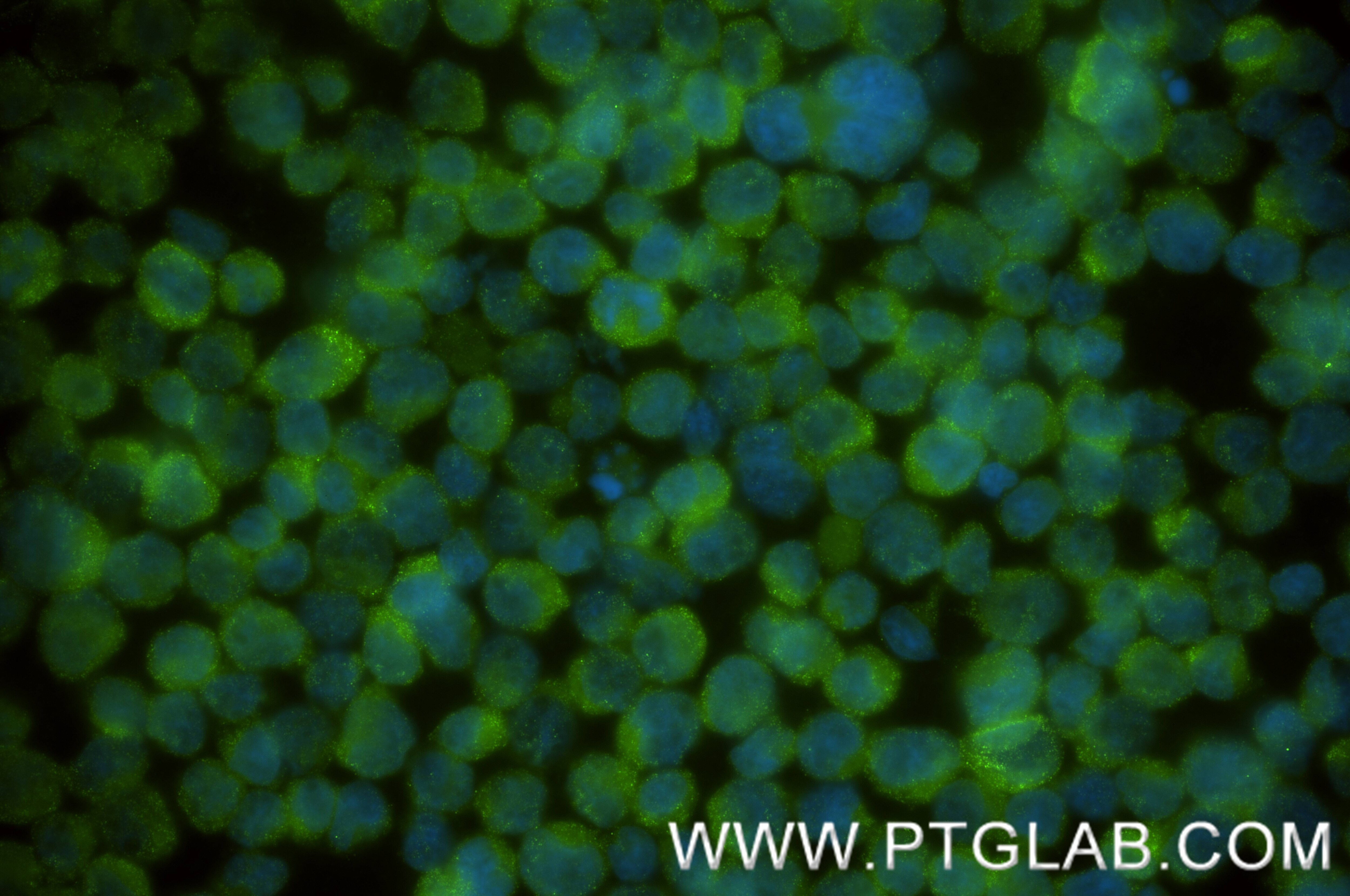 Immunofluorescence (IF) / fluorescent staining of Jurkat cells using NARG1L Recombinant monoclonal antibody (85860-4-RR)