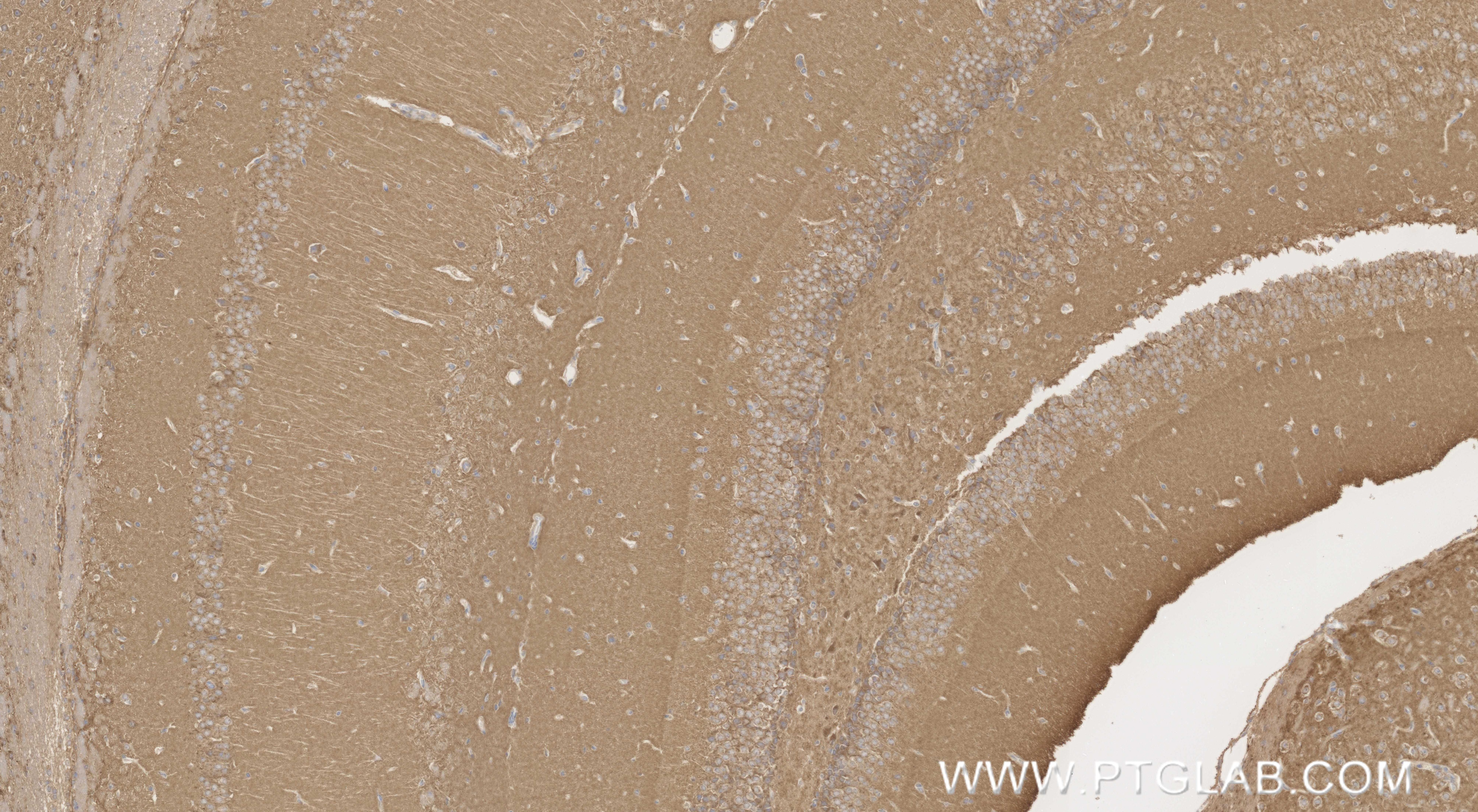 Immunohistochemistry (IHC) staining of mouse brain tissue using NARG1L Recombinant monoclonal antibody (85860-4-RR)