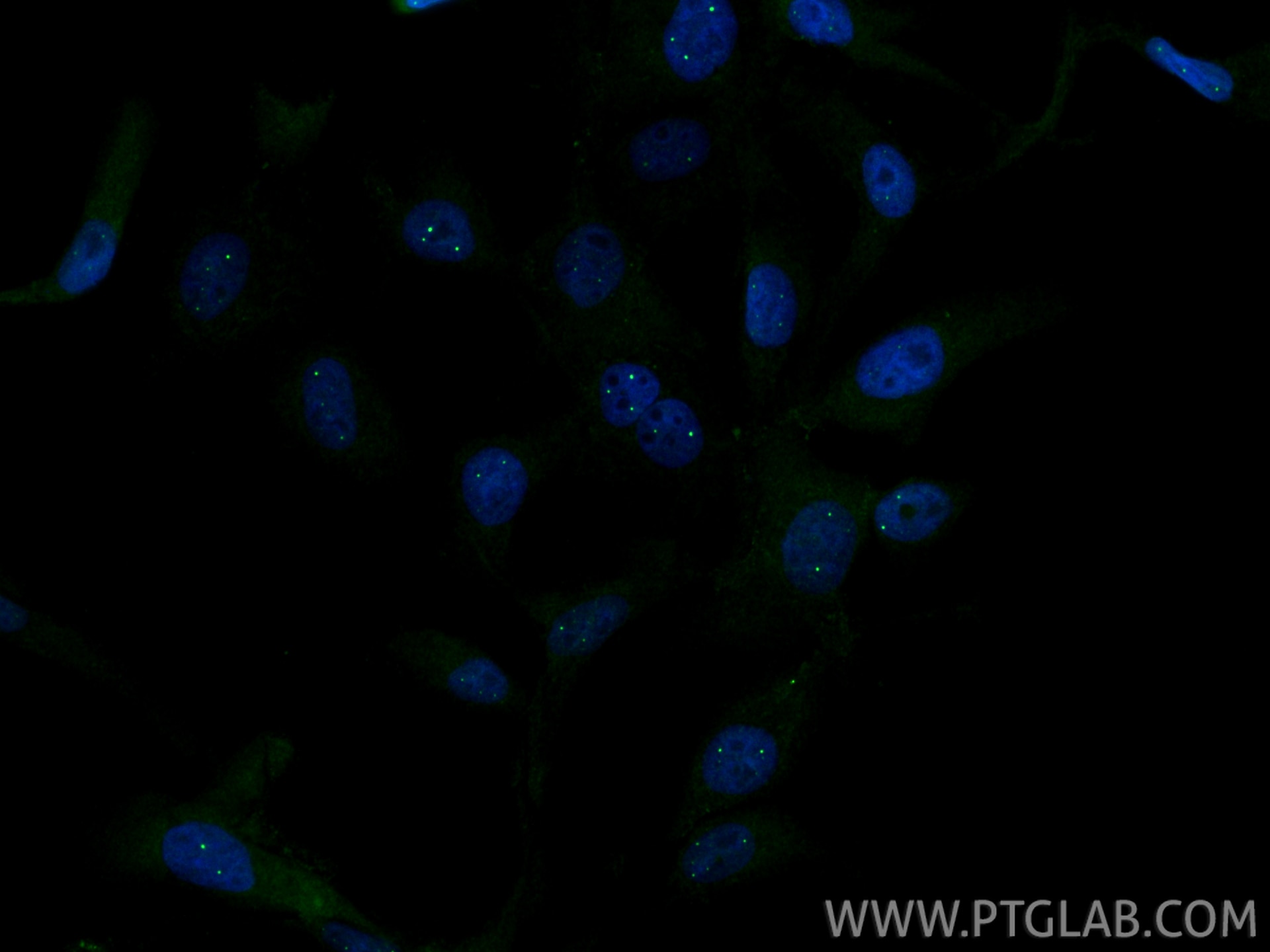 Immunofluorescence (IF) / fluorescent staining of A431 cells using NARG2 Polyclonal antibody (12272-1-AP)