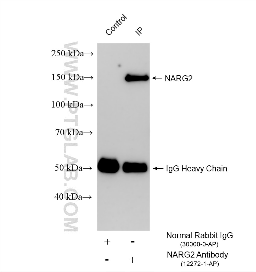 IP result of anti-NARG2 (IP:12272-1-AP, 4ug; Detection:12272-1-AP 1:600) with HEK-293T cells lysate 2080 ug. Immunoprecipitation (IP) experiment of HEK-293T cells using NARG2 Polyclonal antibody (12272-1-AP)