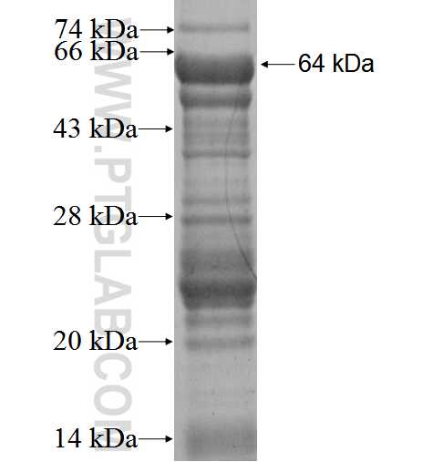NARG2 fusion protein Ag2914 SDS-PAGE