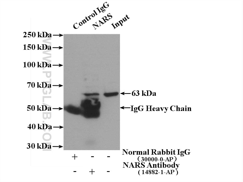 Immunoprecipitation (IP) experiment of HepG2 cells using NARS Polyclonal antibody (14882-1-AP)
