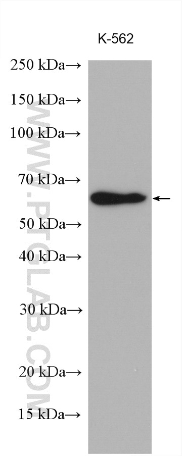 Western Blot (WB) analysis of various lysates using NARS Polyclonal antibody (14882-1-AP)