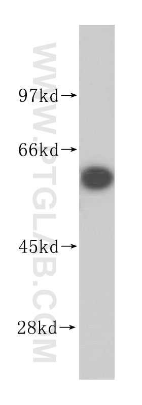 Western Blot (WB) analysis of HepG2 cells using NARS Polyclonal antibody (14882-1-AP)