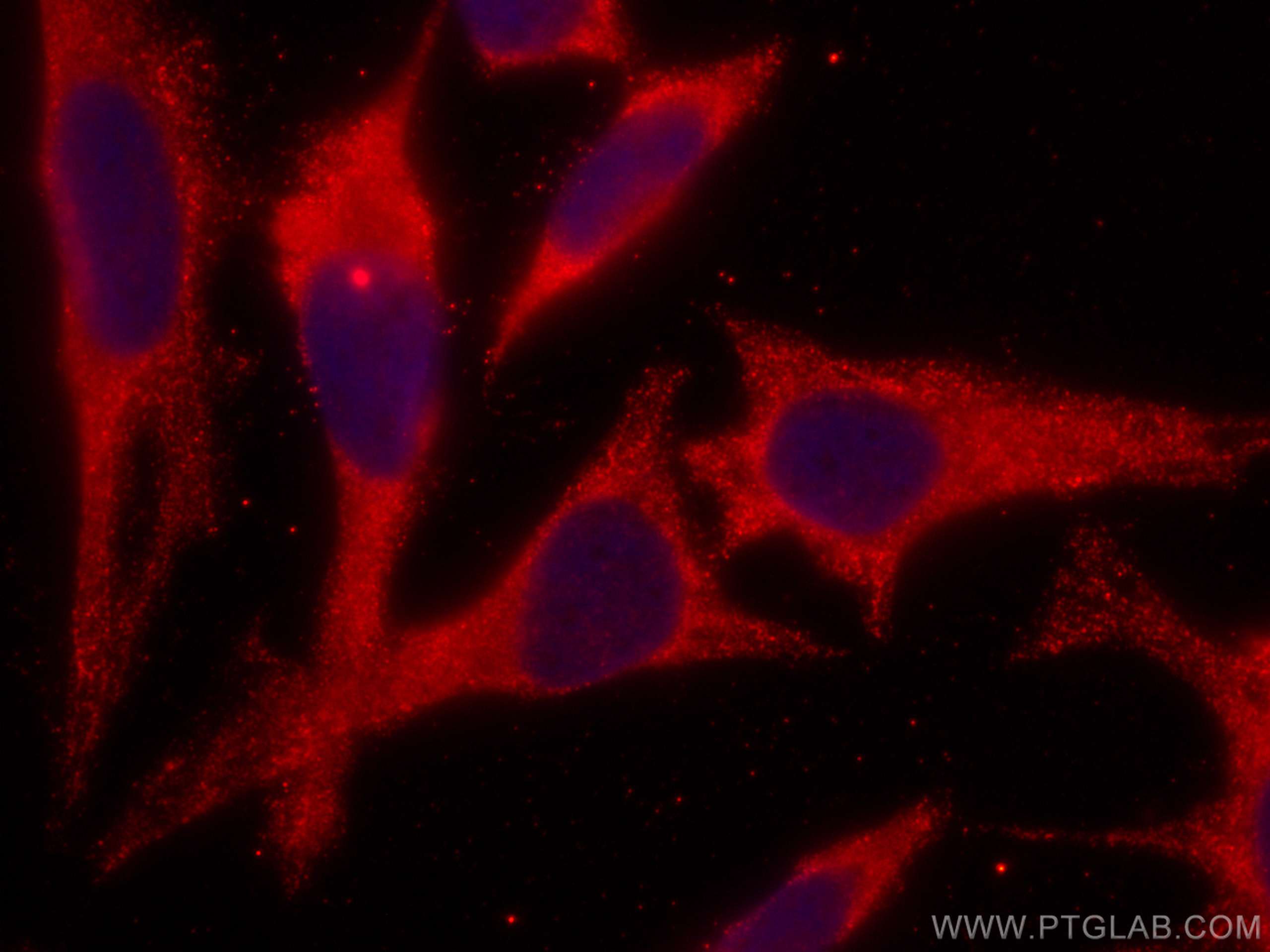 Immunofluorescence (IF) / fluorescent staining of HeLa cells using CoraLite®594-conjugated NARS Monoclonal antibody (CL594-67711)