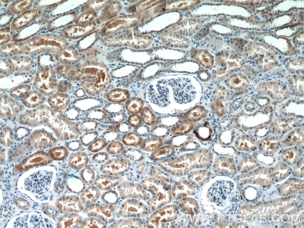 IHC staining of human kidney using 15714-1-AP