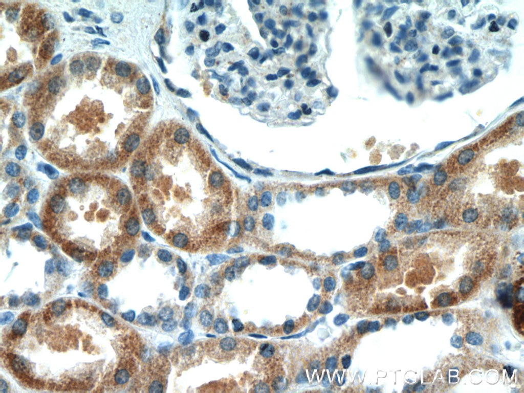 Immunohistochemistry (IHC) staining of human kidney tissue using NARS2 Polyclonal antibody (15714-1-AP)