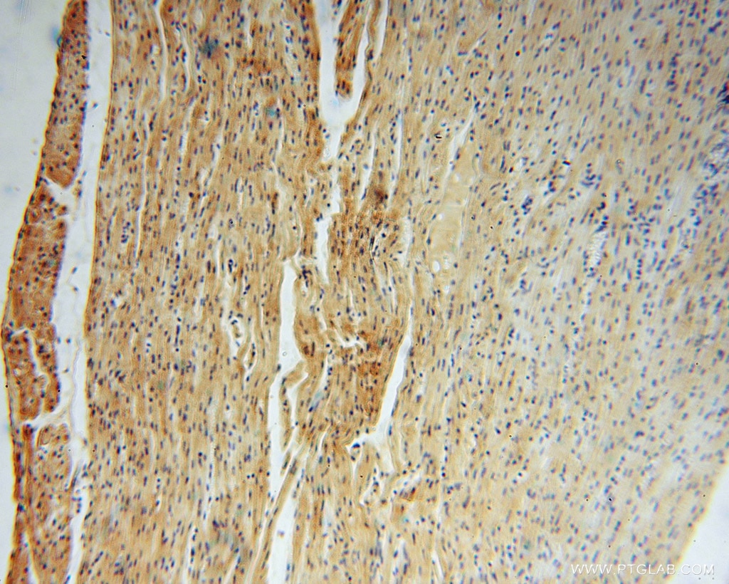 Immunohistochemistry (IHC) staining of human heart tissue using NARS2 Polyclonal antibody (15714-1-AP)