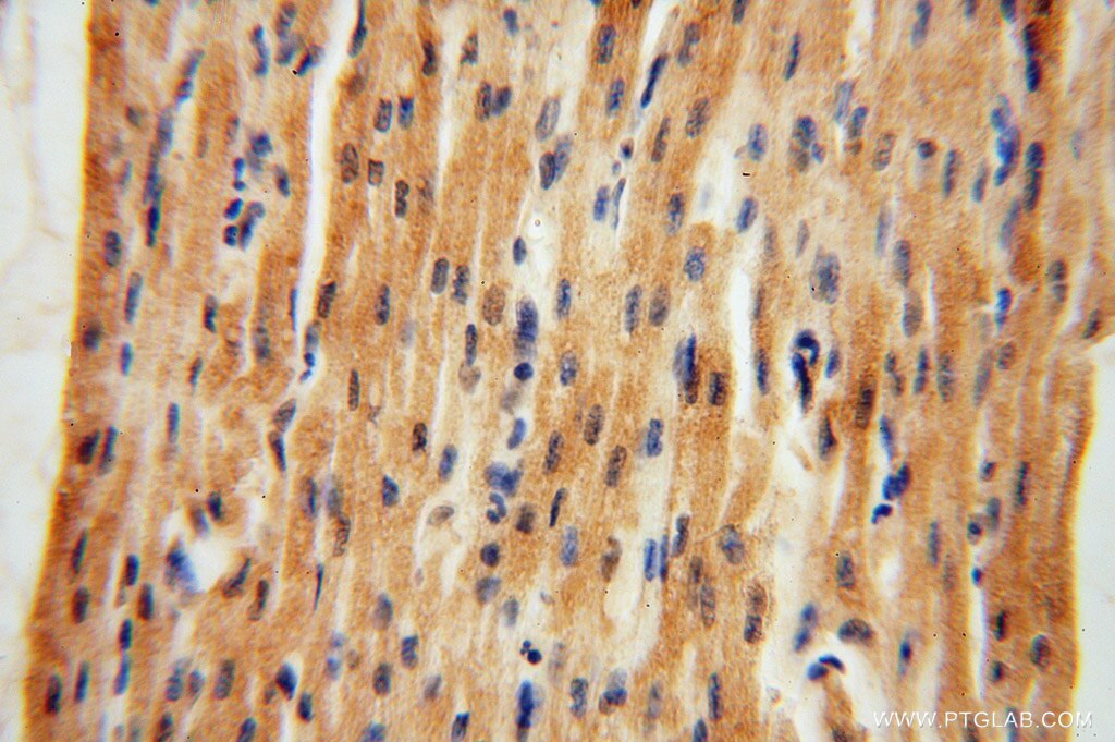 Immunohistochemistry (IHC) staining of human heart tissue using NARS2 Polyclonal antibody (15714-1-AP)