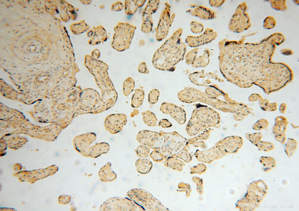 Immunohistochemistry (IHC) staining of human placenta tissue using NARS2 Polyclonal antibody (15714-1-AP)