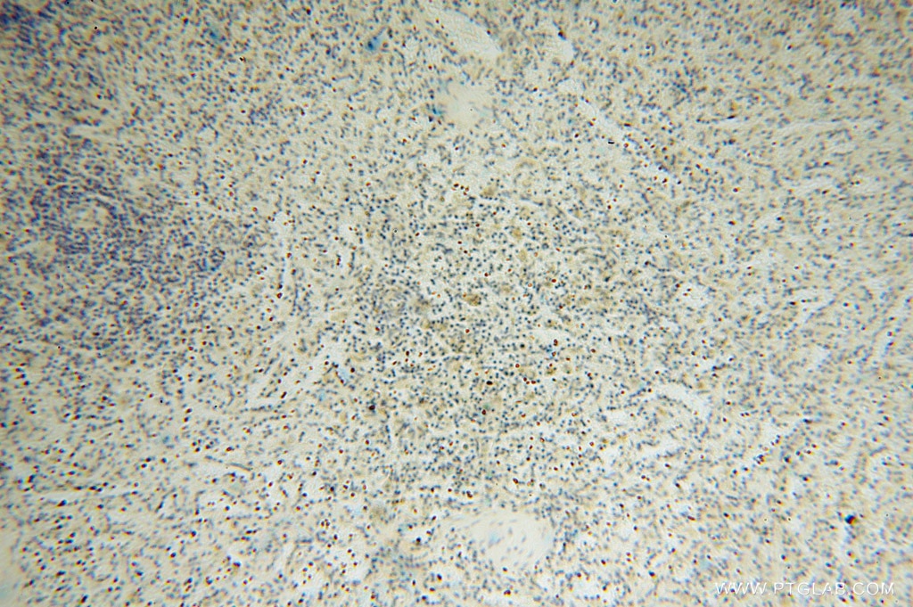 Immunohistochemistry (IHC) staining of human spleen tissue using NARS2 Polyclonal antibody (15714-1-AP)