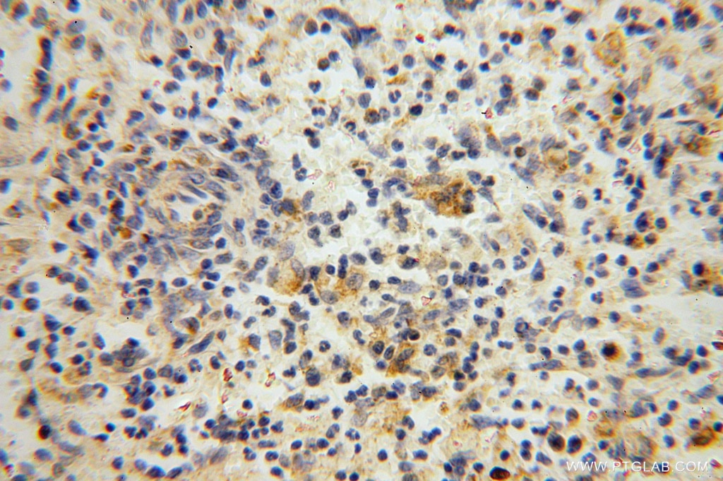 Immunohistochemistry (IHC) staining of human spleen tissue using NARS2 Polyclonal antibody (15714-1-AP)