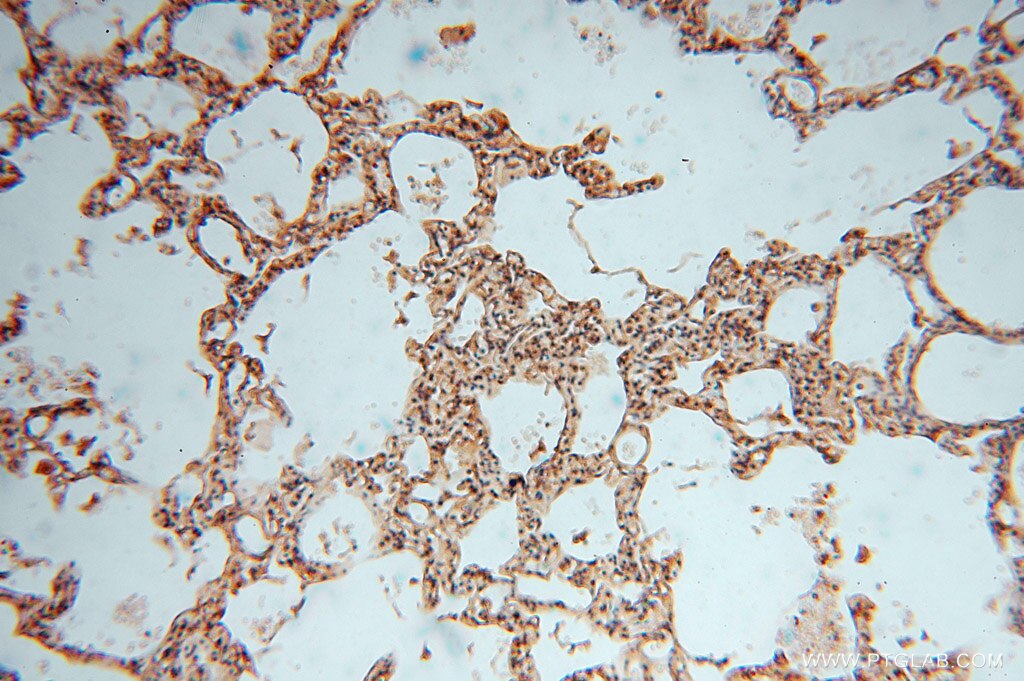 Immunohistochemistry (IHC) staining of human lung tissue using NARS2 Polyclonal antibody (15714-1-AP)