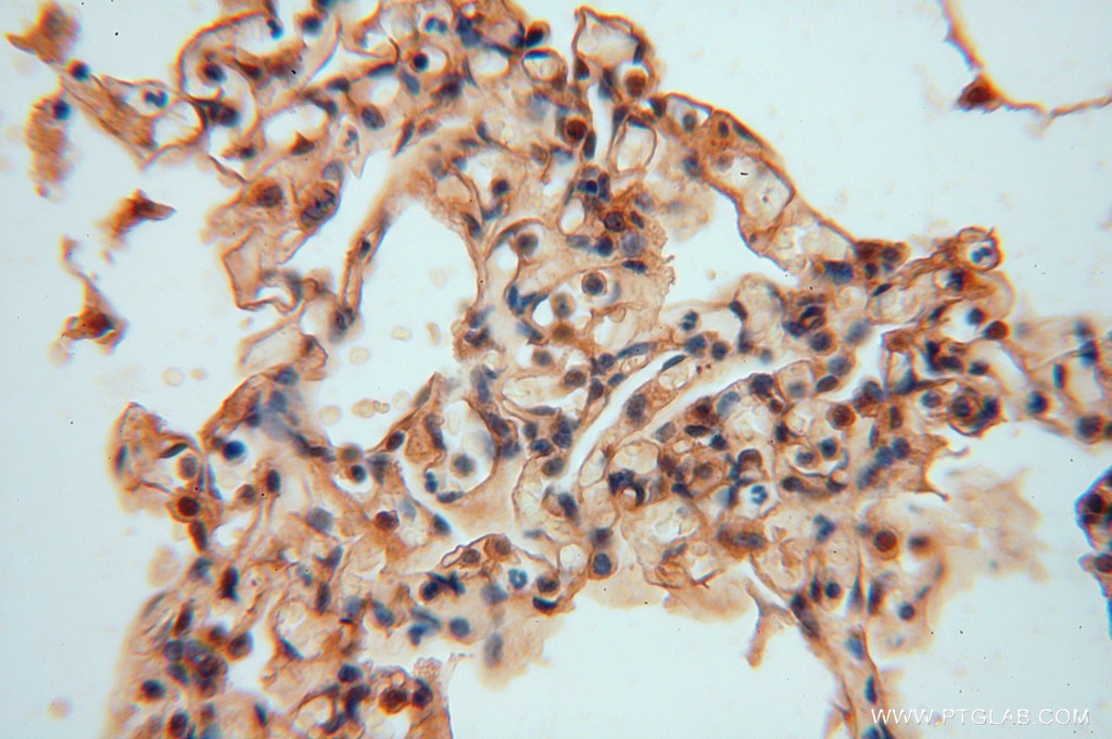 Immunohistochemistry (IHC) staining of human lung tissue using NARS2 Polyclonal antibody (15714-1-AP)