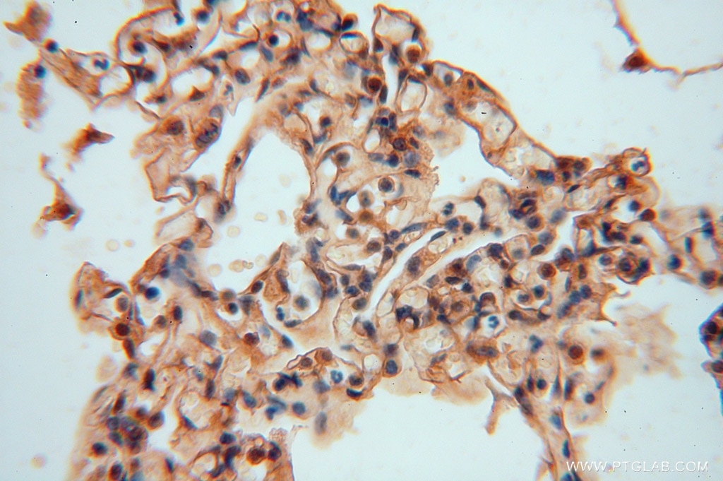 IHC staining of human lung using 15714-1-AP