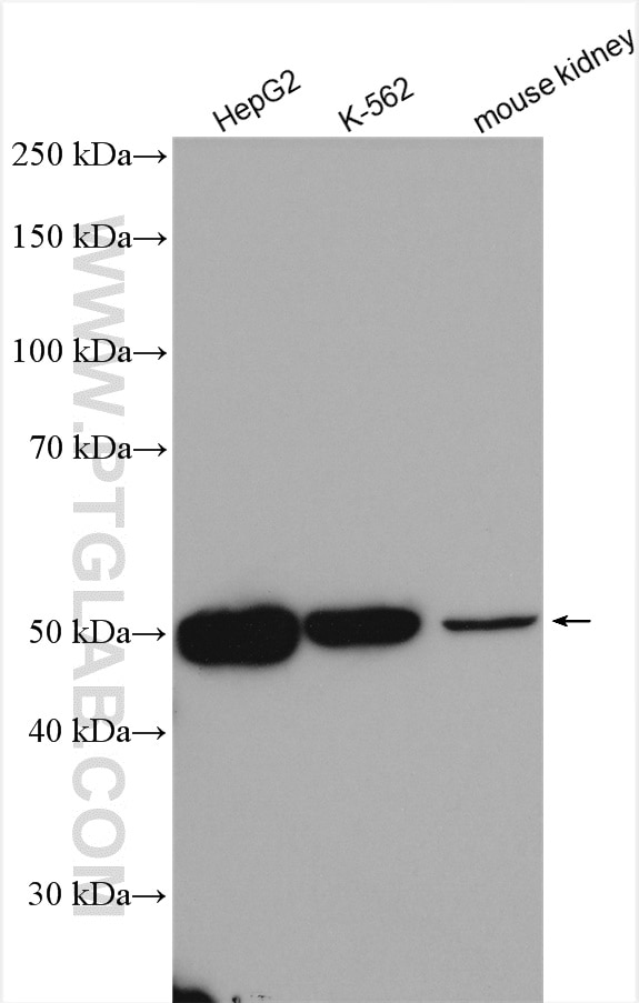 Western Blot (WB) analysis of various lysates using NARS2 Polyclonal antibody (15714-1-AP)