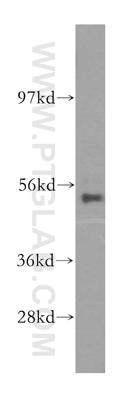 Western Blot (WB) analysis of human brain tissue using NARS2 Polyclonal antibody (15714-1-AP)