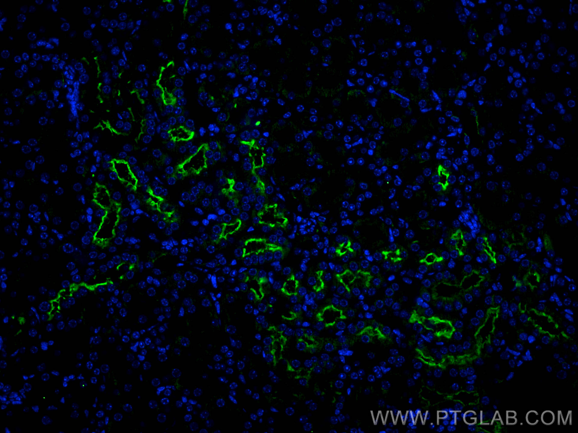 Immunofluorescence (IF) / fluorescent staining of mouse kidney tissue using NAS1/SLC13A1 Polyclonal antibody (25039-1-AP)