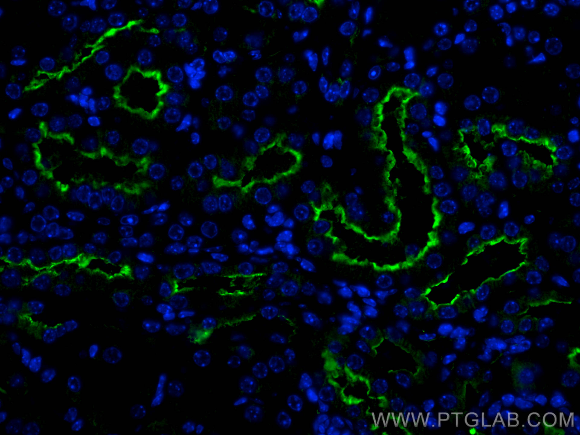 IF Staining of mouse kidney using 25039-1-AP