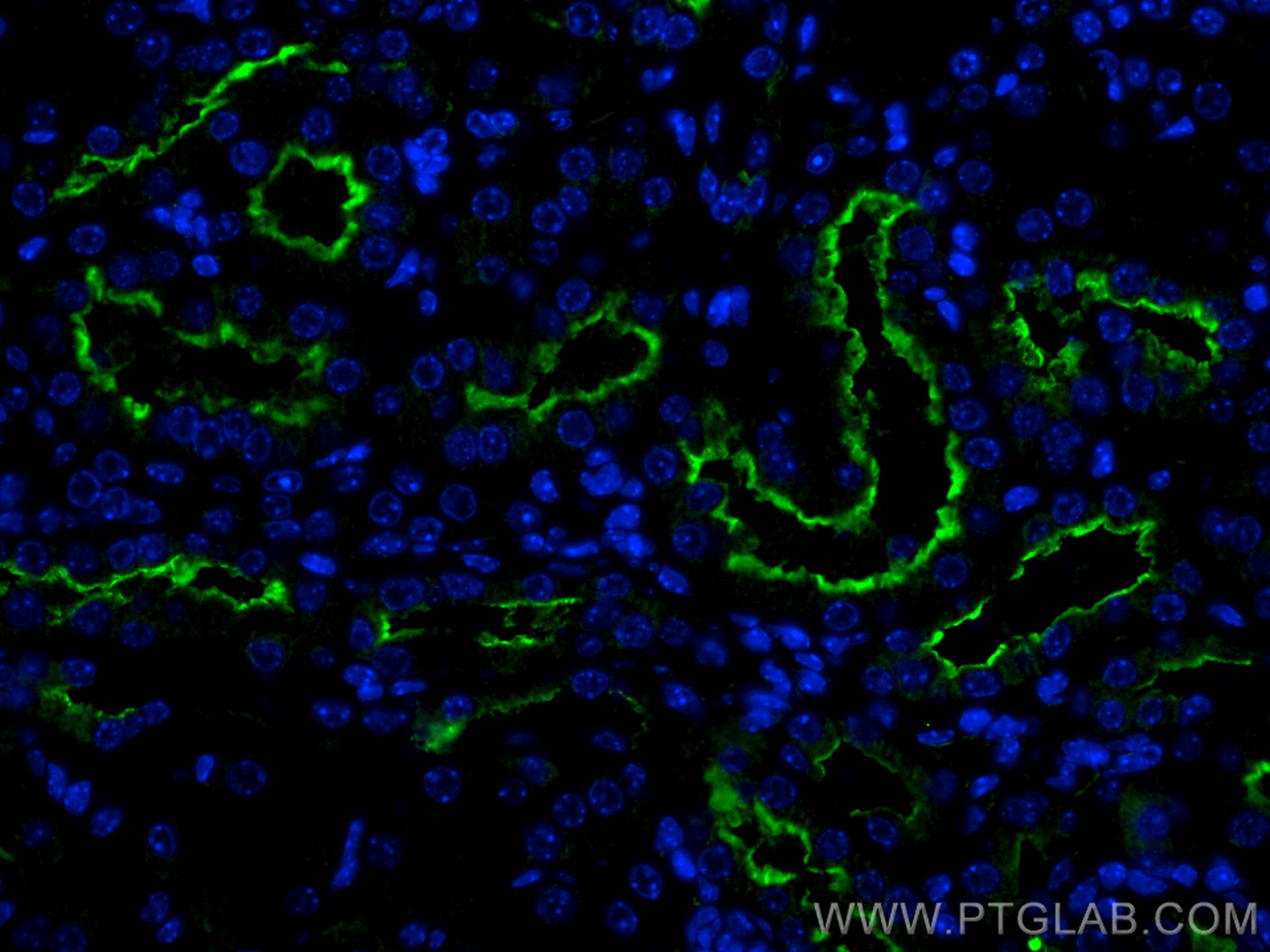 Immunofluorescence (IF) / fluorescent staining of mouse kidney tissue using NAS1/SLC13A1 Polyclonal antibody (25039-1-AP)