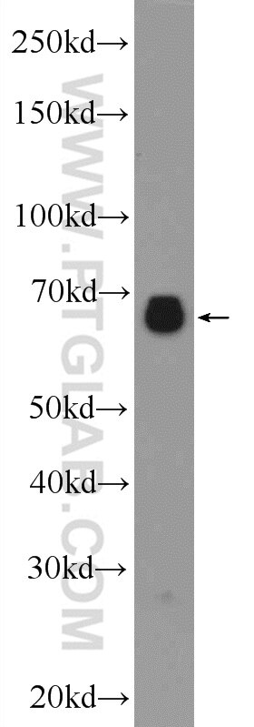 Western Blot (WB) analysis of mouse kidney tissue using NAS1/SLC13A1 Polyclonal antibody (25039-1-AP)