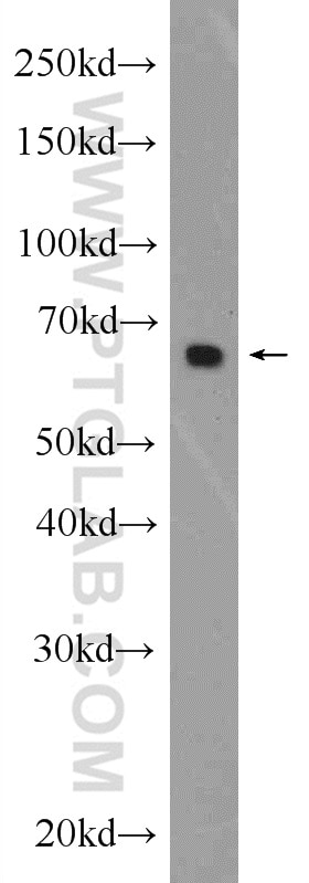 Western Blot (WB) analysis of HEK-293 cells using NAS1/SLC13A1 Polyclonal antibody (25039-1-AP)