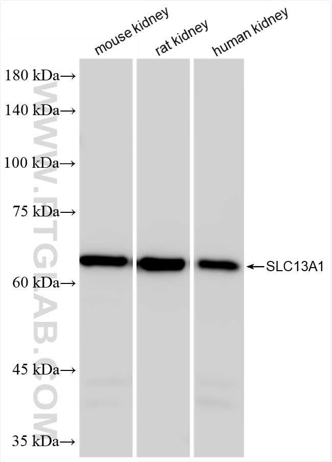 Various lysates were subjected to SDS PAGE followed by western blot with 86476-1-RR (NAS1/SLC13A1 antibody) at dilution of 1:10000 incubated at room temperature for 1.5 hours. Western Blot (WB) analysis of various lysates using NAS1/SLC13A1 Recombinant antibody (86476-1-RR)