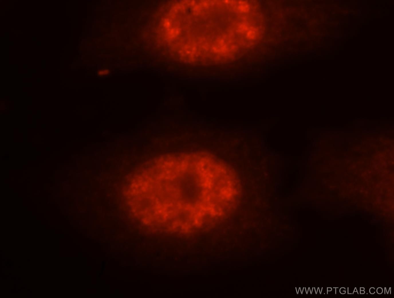 Immunofluorescence (IF) / fluorescent staining of MCF-7 cells using NASP Polyclonal antibody (11323-1-AP)