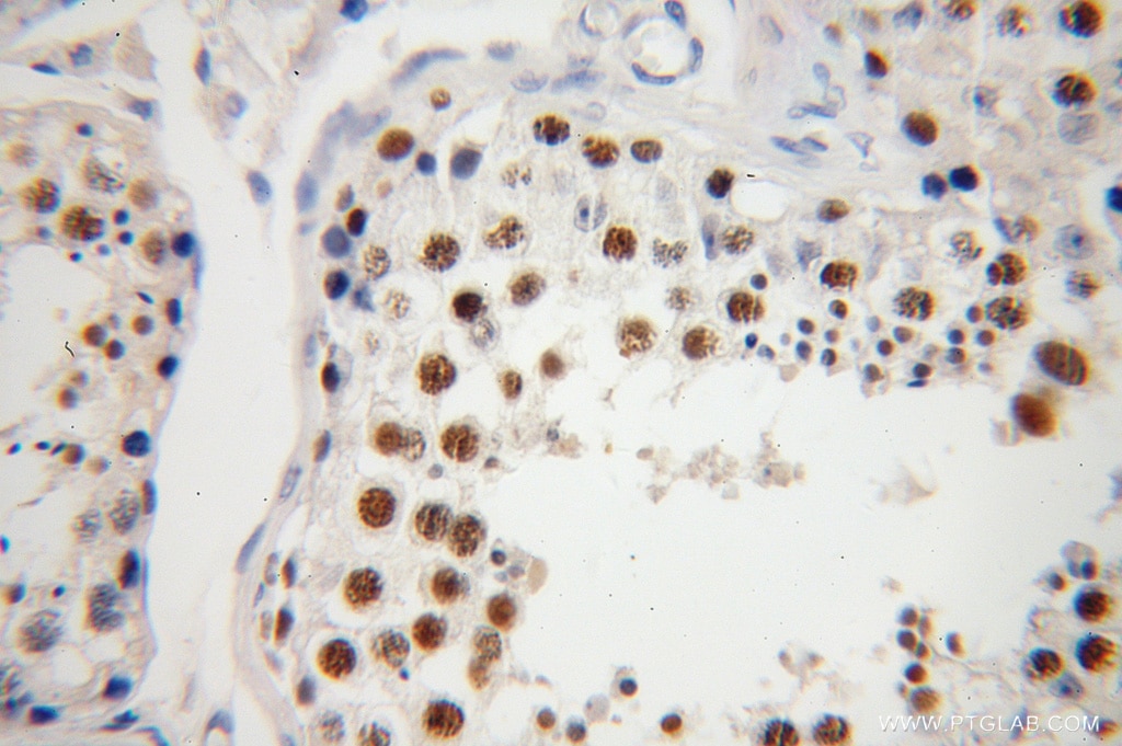 Immunohistochemistry (IHC) staining of human testis tissue using NASP Polyclonal antibody (11323-1-AP)