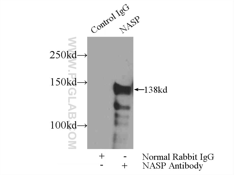 Immunoprecipitation (IP) experiment of mouse testis tissue using NASP Polyclonal antibody (11323-1-AP)