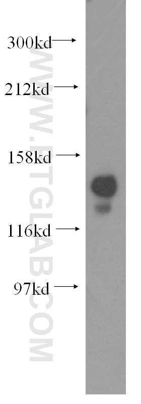 Western Blot (WB) analysis of mouse testis tissue using NASP Polyclonal antibody (11323-1-AP)