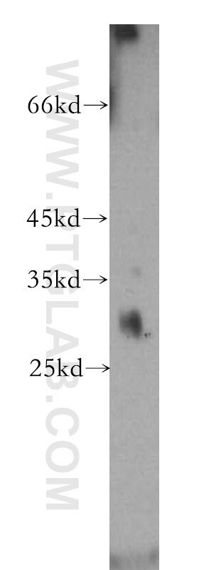 Western Blot (WB) analysis of PC-3 cells using NAT1 Polyclonal antibody (14394-1-AP)