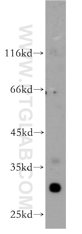 Western Blot (WB) analysis of A375 cells using NAT1 Polyclonal antibody (14394-1-AP)