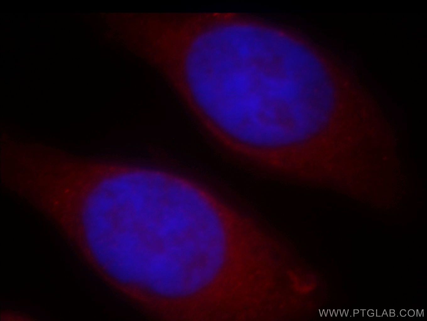 Immunofluorescence (IF) / fluorescent staining of HeLa cells using NAT1 Polyclonal antibody (19188-1-AP)