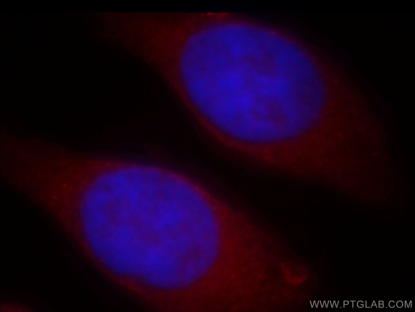 IF Staining of HeLa using 19188-1-AP